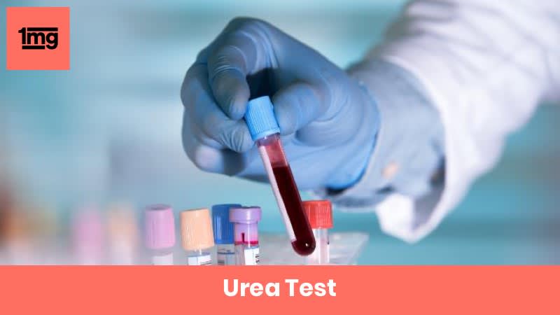 Urea Test