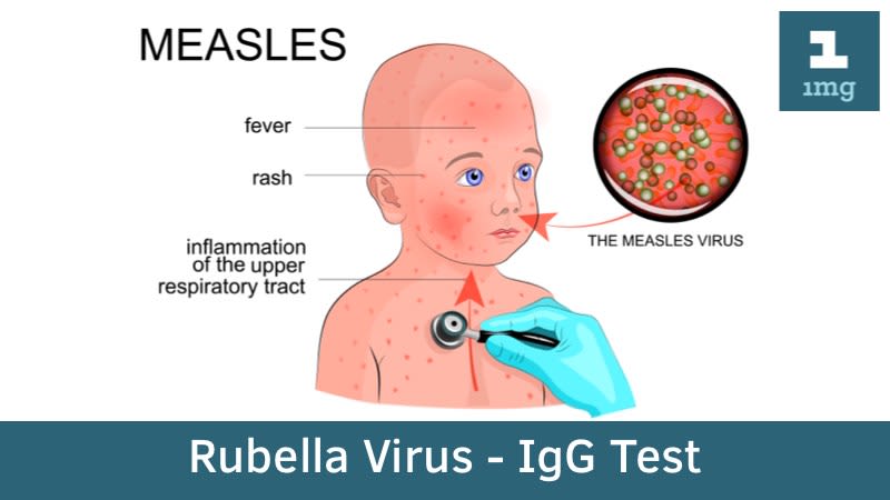 Rubella Virus - IgG
