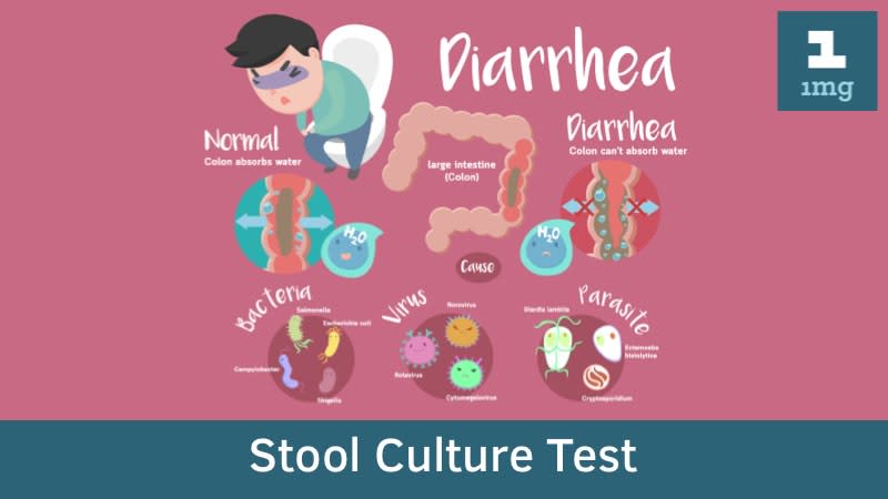 Culture Stool