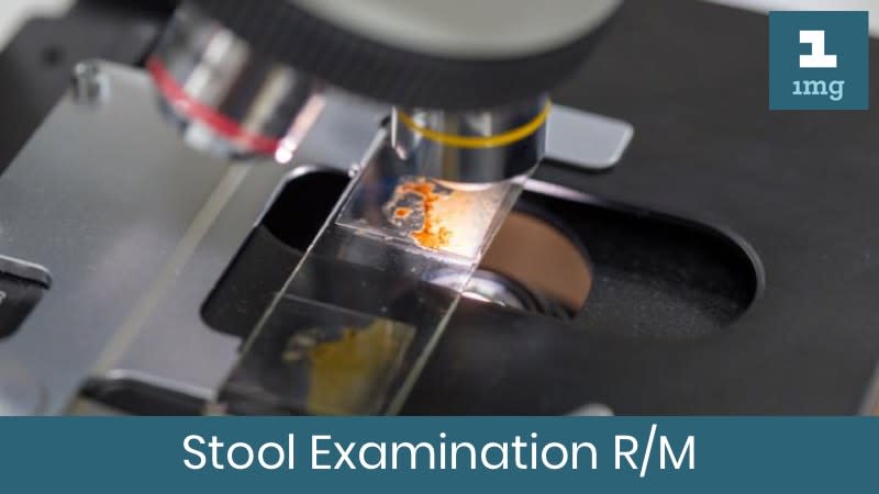 Stool Examination R/M