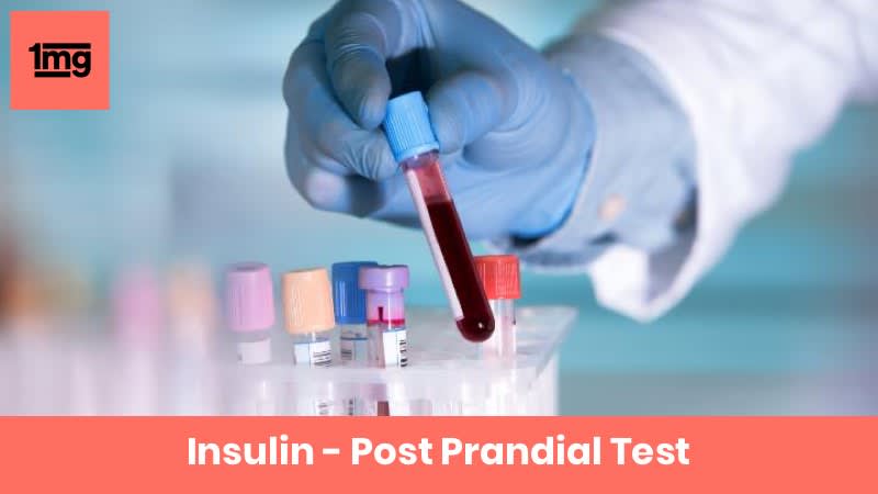 Insulin - Post Prandial