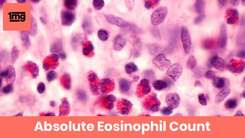 Absolute Eosinophil Count