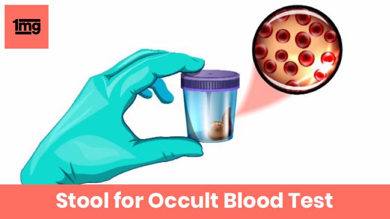 Stool For Occult Blood