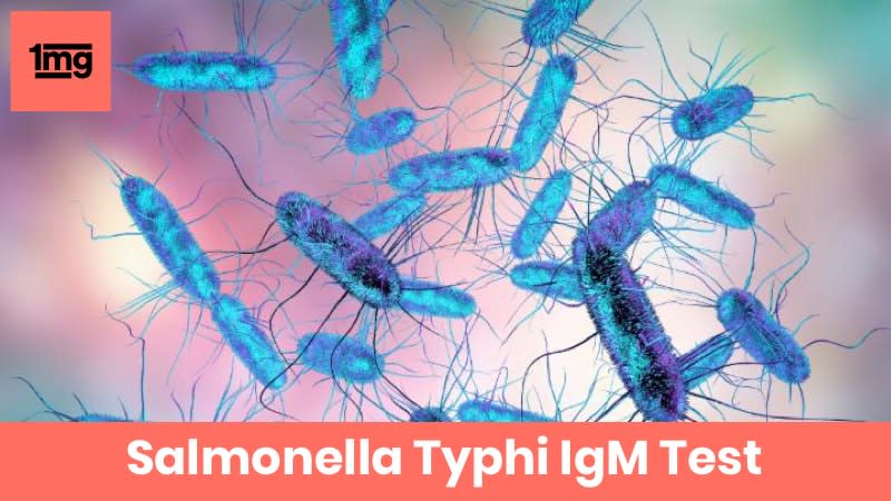 Salmonella Typhi IgM