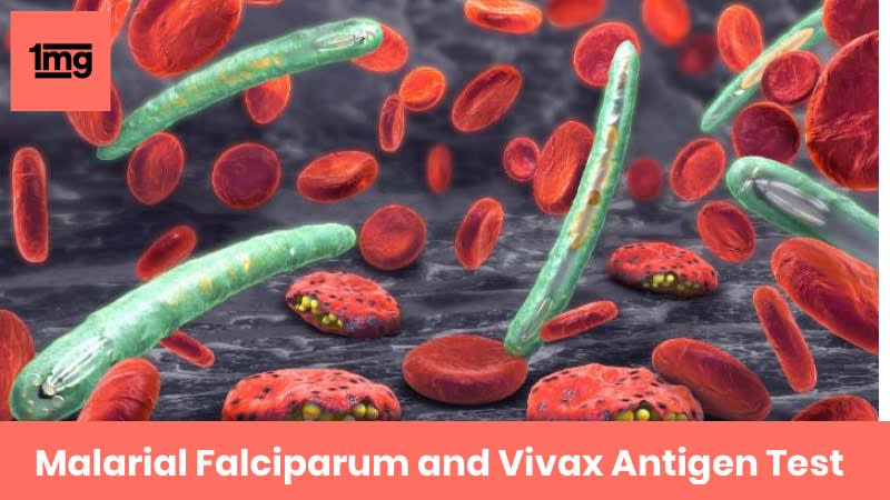 Malarial Falciparum and Vivax Antigen