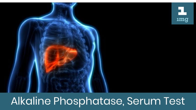 Alkaline Phosphatase, Serum