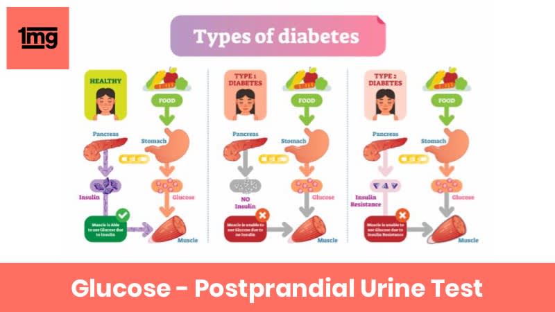Glucose - Postprandial Urine