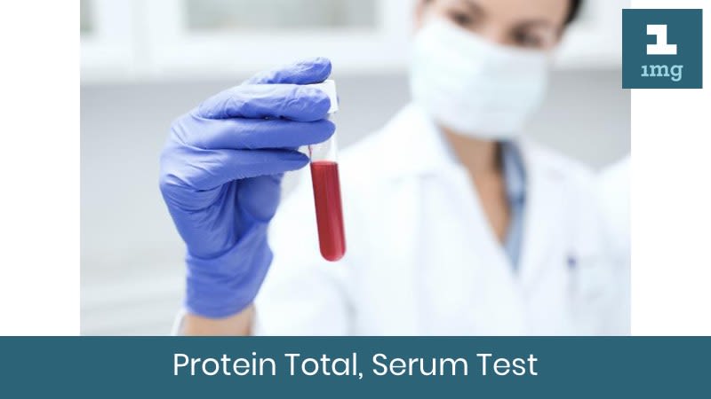 Protein Total, Serum