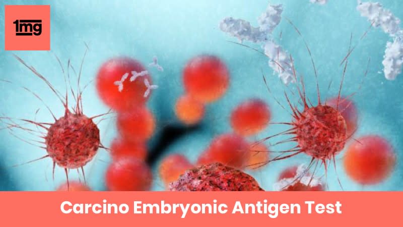 Carcino Embryonic Antigen
