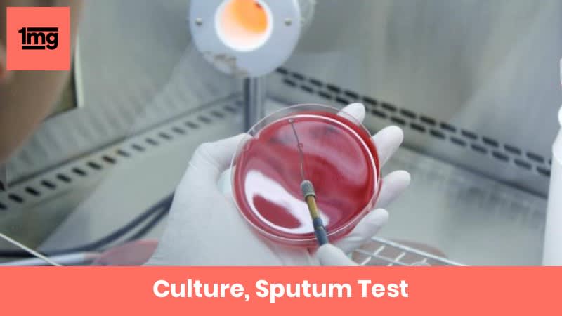 Culture, Sputum