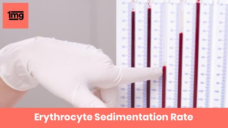 Erythrocyte Sedimentation Rate Esr Purpose Normal Range Of Results 1mg