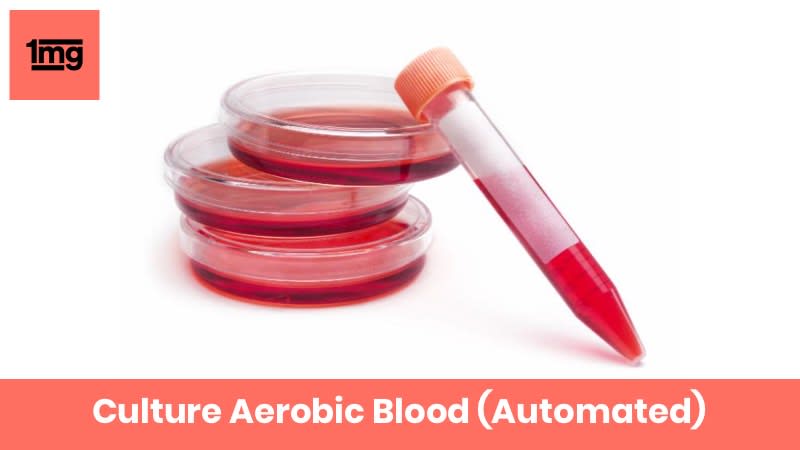 Culture Aerobic Blood (Automated)