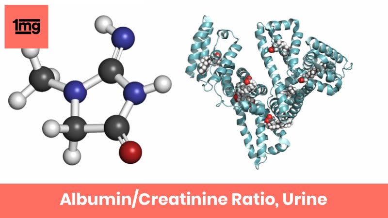 Albumin/Creatinine Ratio Urine