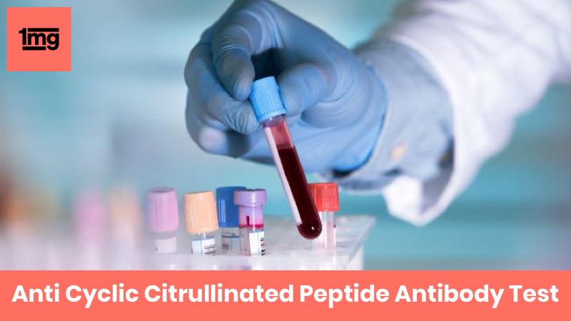 Anti Cyclic Citrullinated Peptide Antibody (Anti CCP