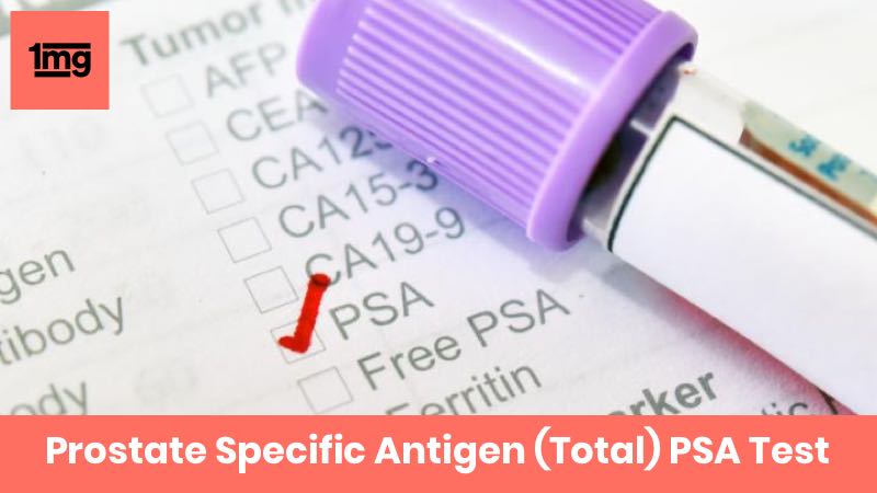 Prostate Specific Antigen Total Psa Purpose And Normal Range Of Results 1mg 5190