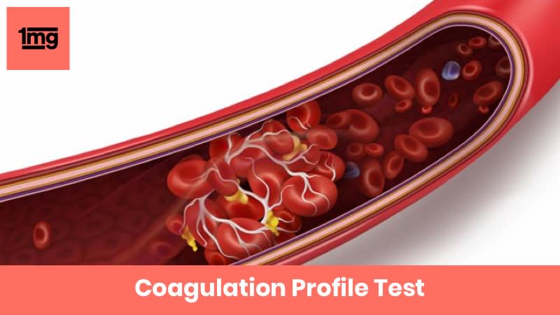 Coagulation Profile