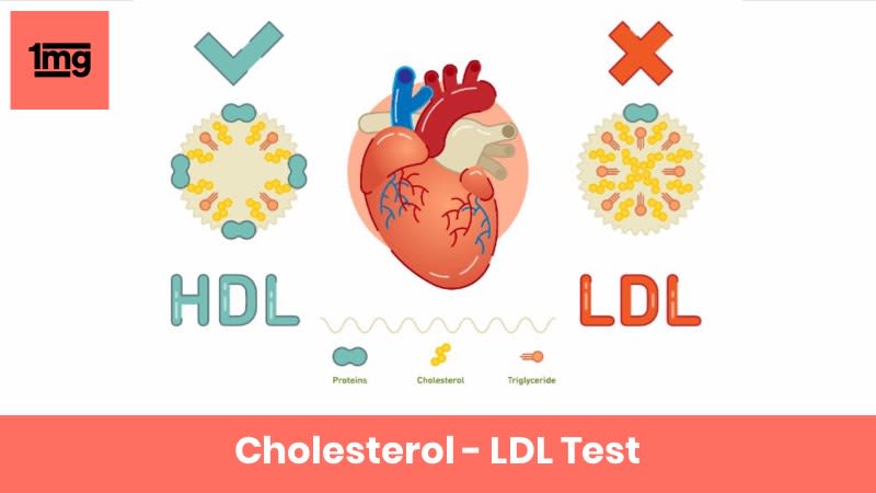 ldl cholesterol range 77