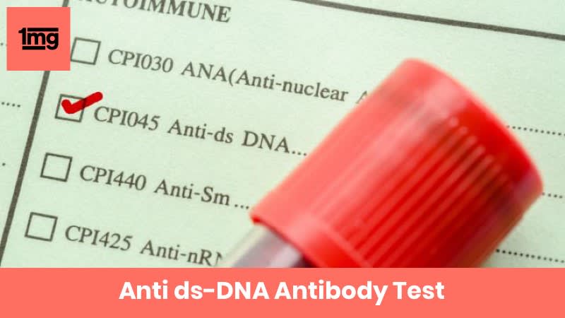 Anti ds-DNA Antibody