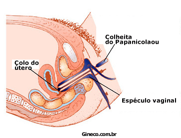 Introdução do espéculo Introdução do especulo