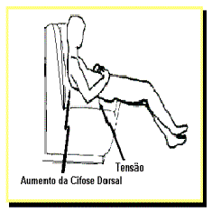 Má postura: aumento da cifose dorsal Má postura: aumento da cifose dorsal