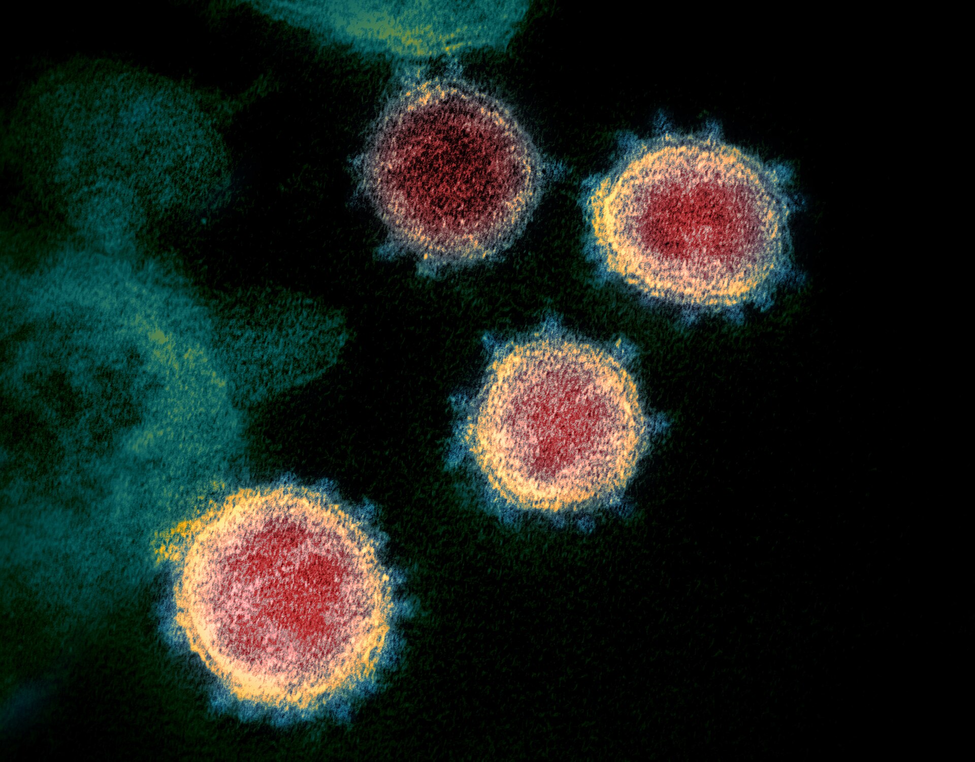 Cover image for Did Covid-19 come from nature or from a lab?