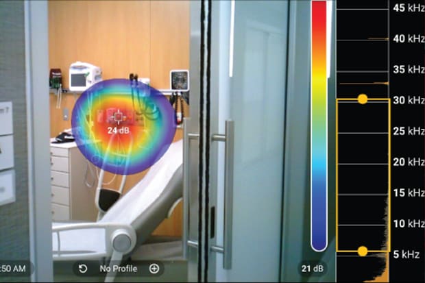 ii900 Acoustic Imager in Health Care