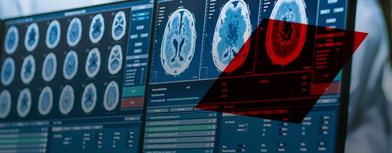 MRI readings
