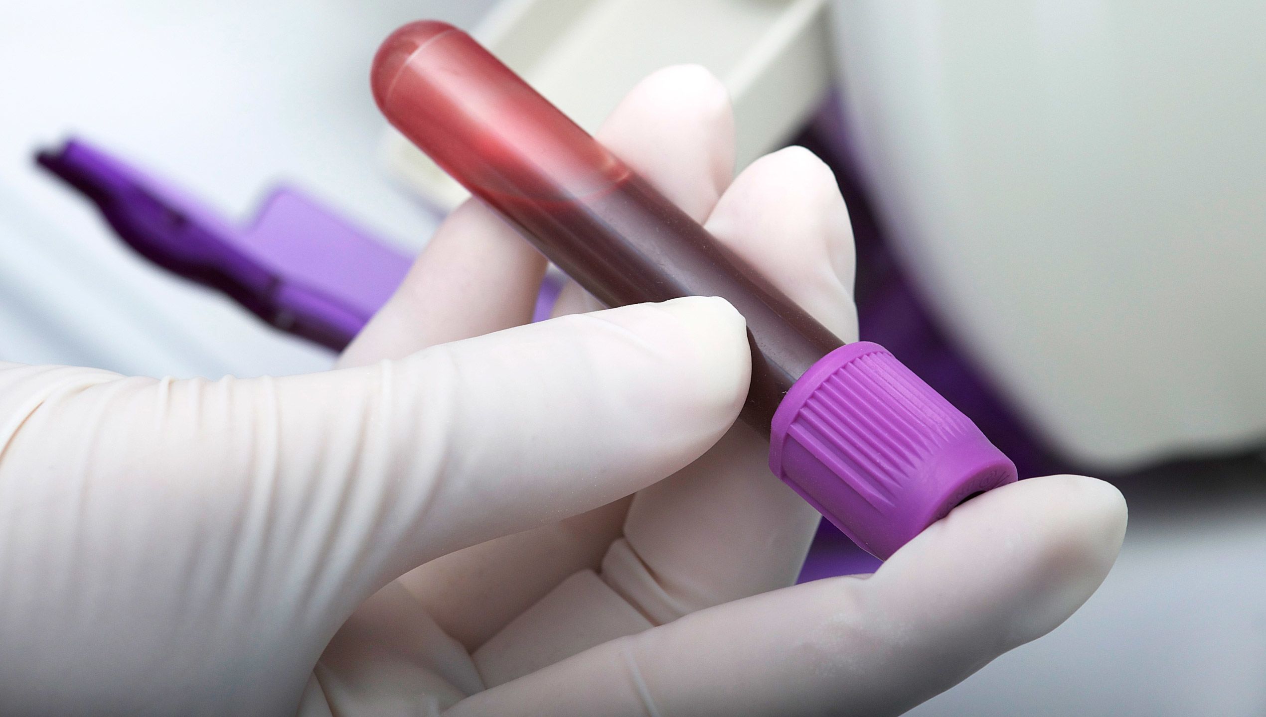 The health complications of hepatitis C
