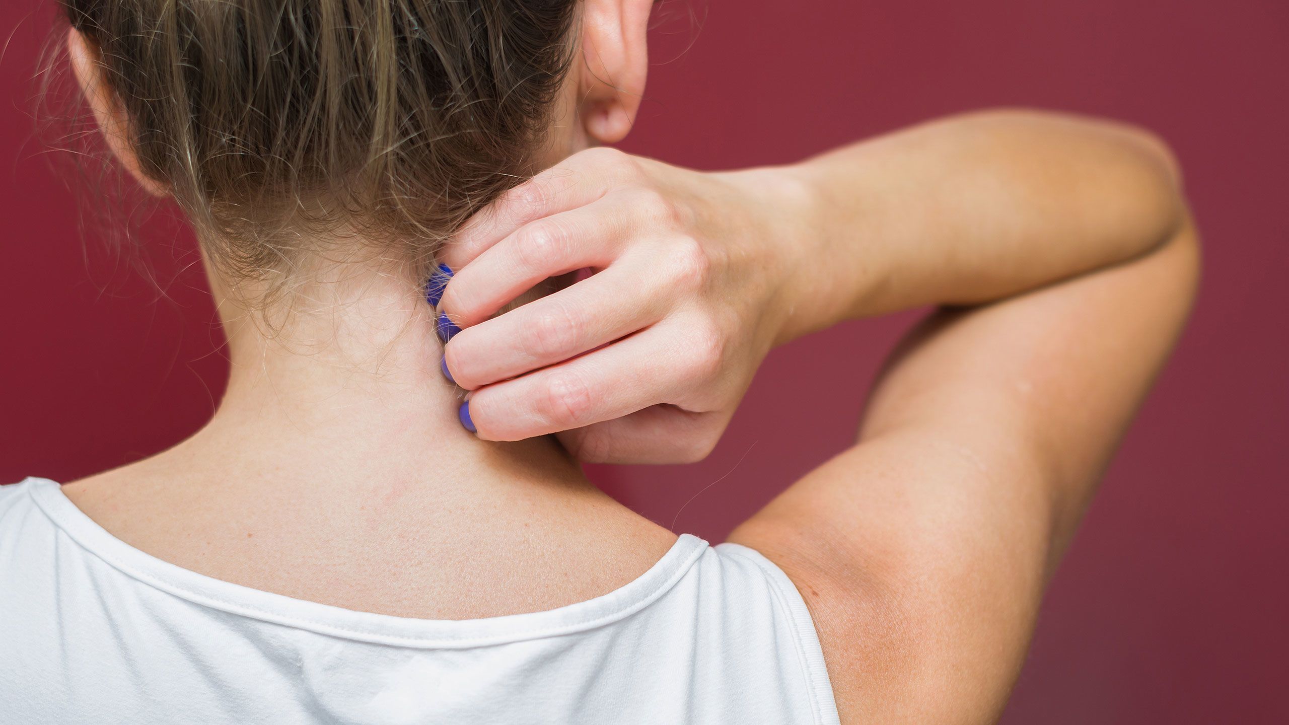 Why atopic dermatitis is more than just dry skin