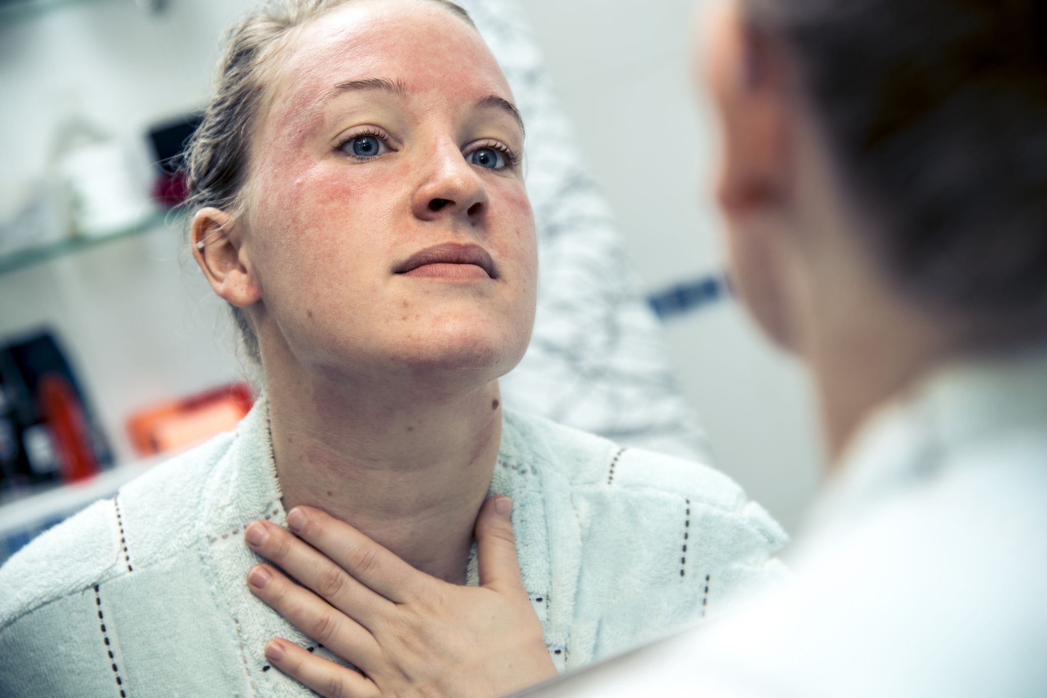 7 answers about angioedema