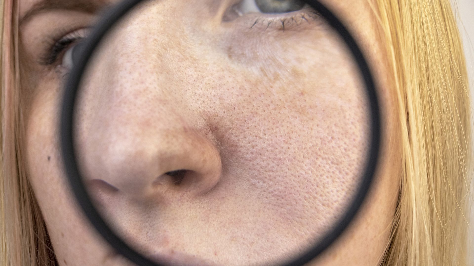 What a dermatologist wants you to know about skin cancer