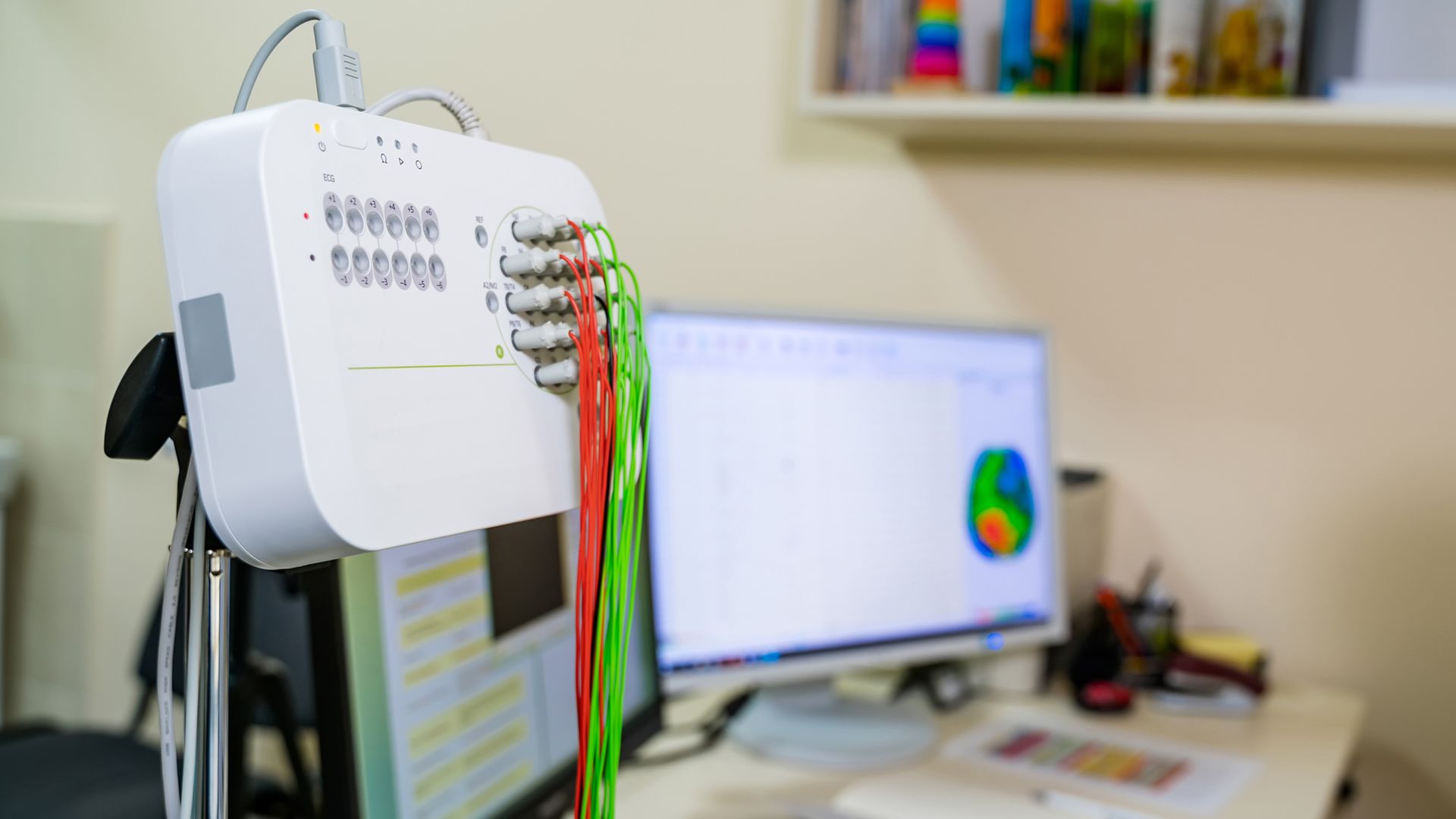 Understanding epileptic seizures