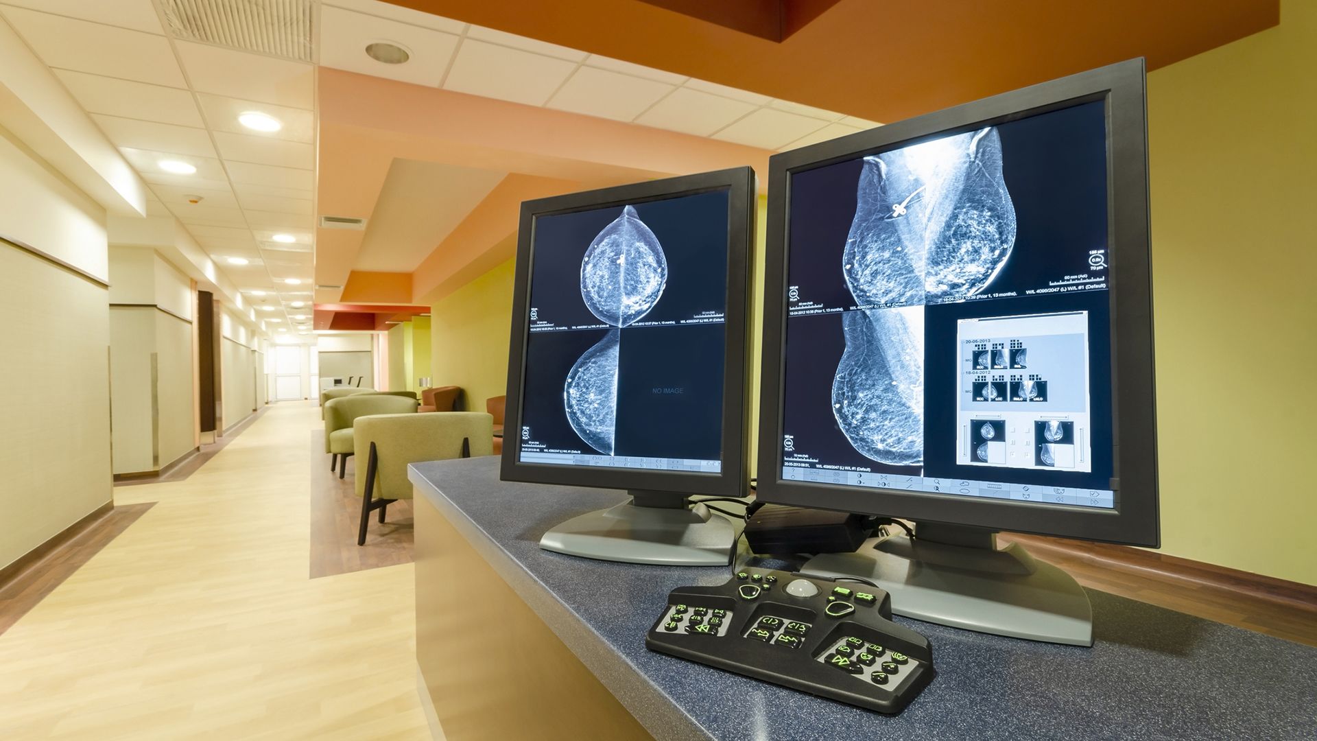 What is triple-negative breast cancer?