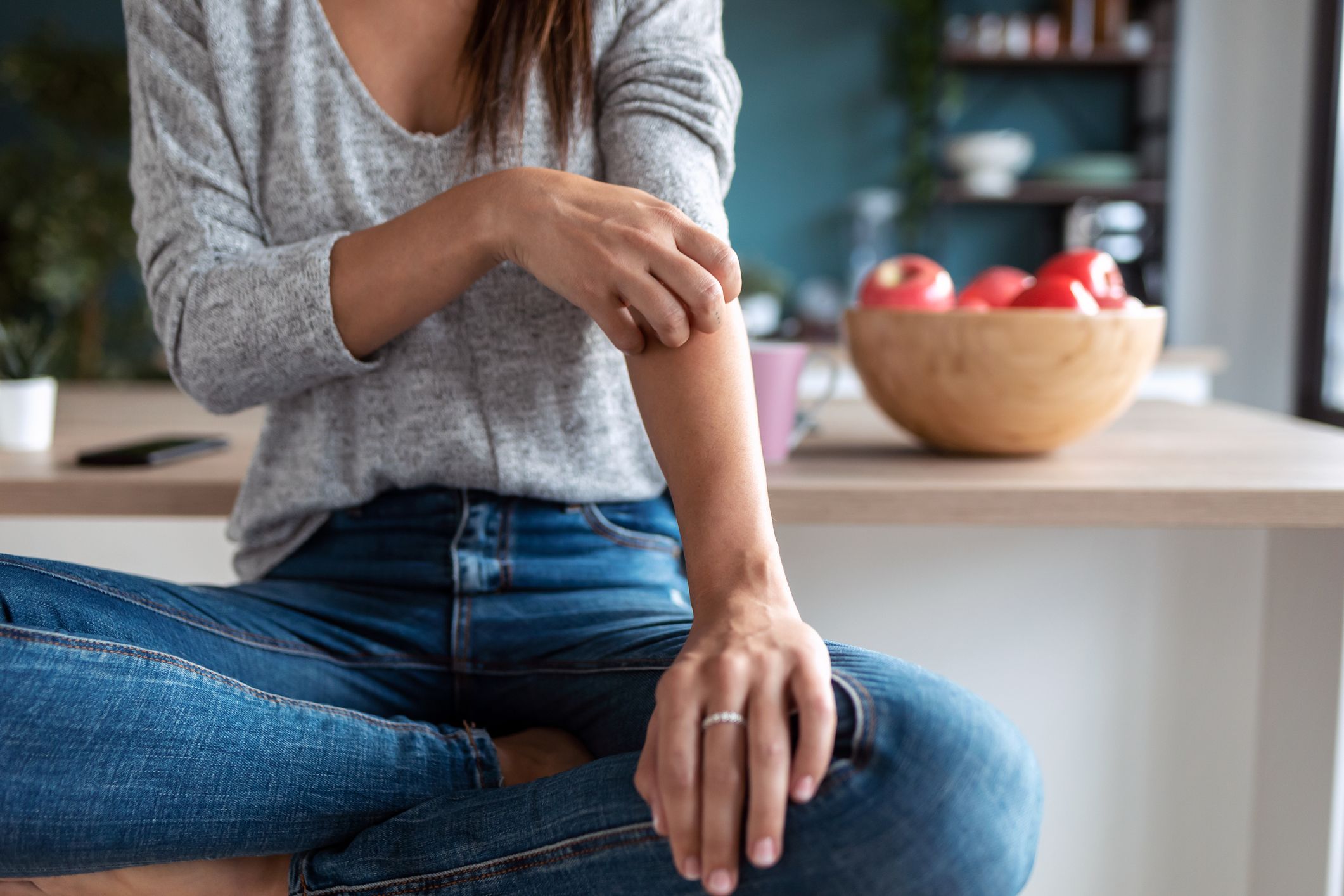 4 important differences between psoriasis and eczema