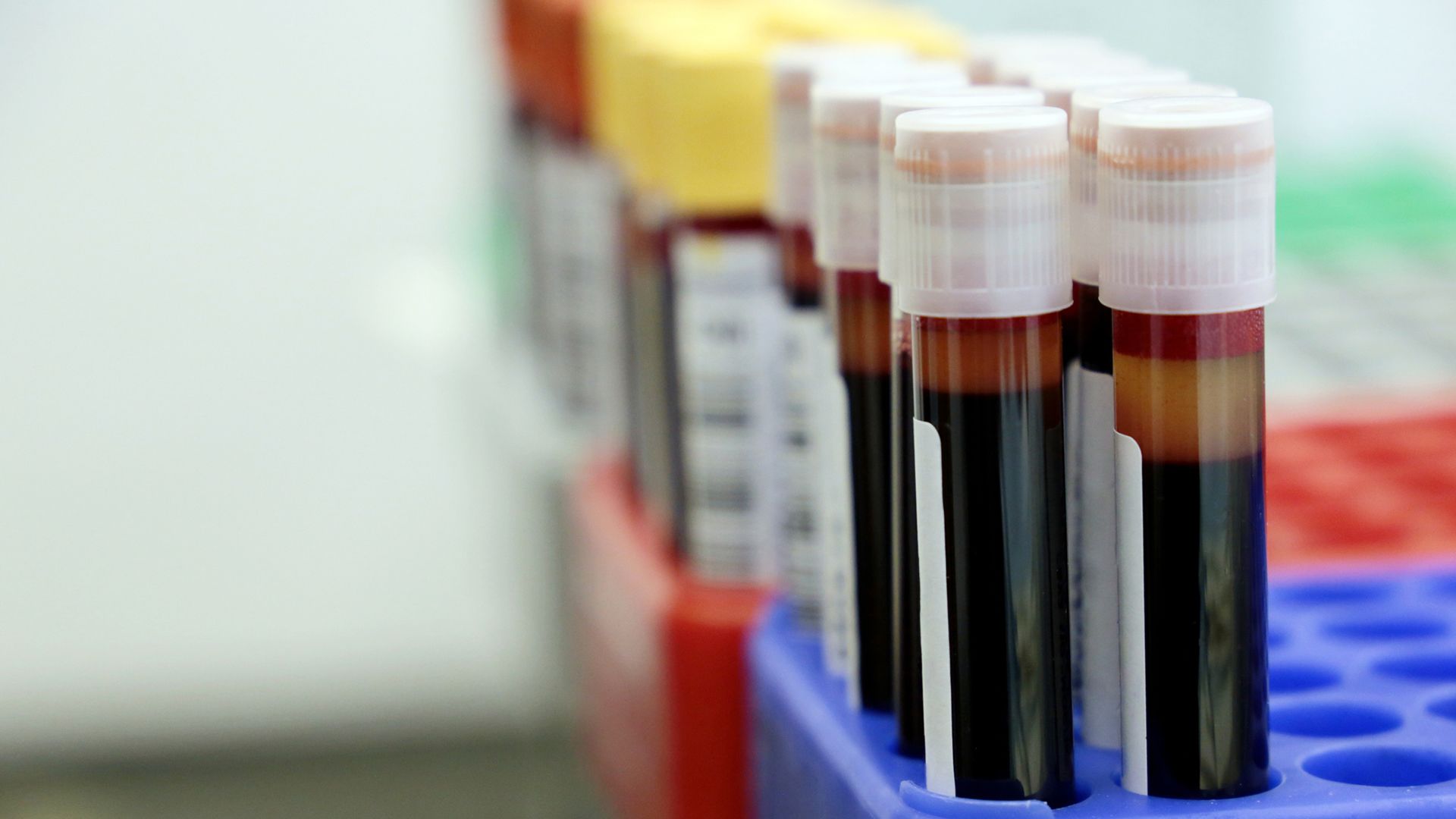 Must-know anemia facts and warning signs