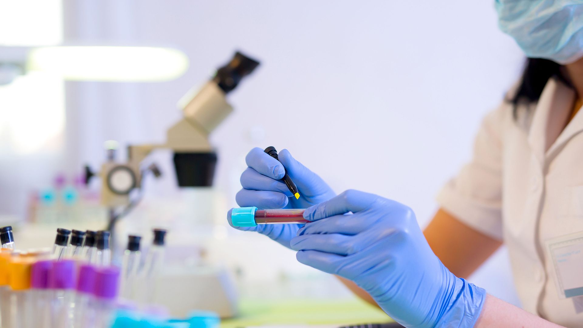 What is CAR T-cell therapy for non-Hodgkin lymphoma?