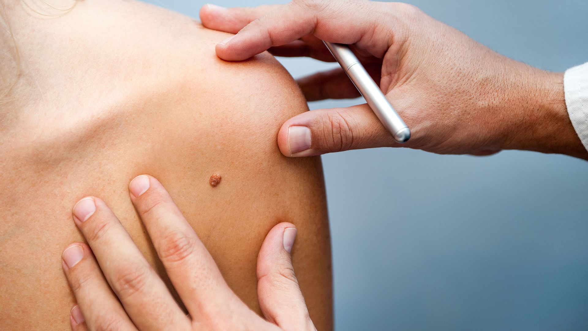 Effective treatments options for skin cancer