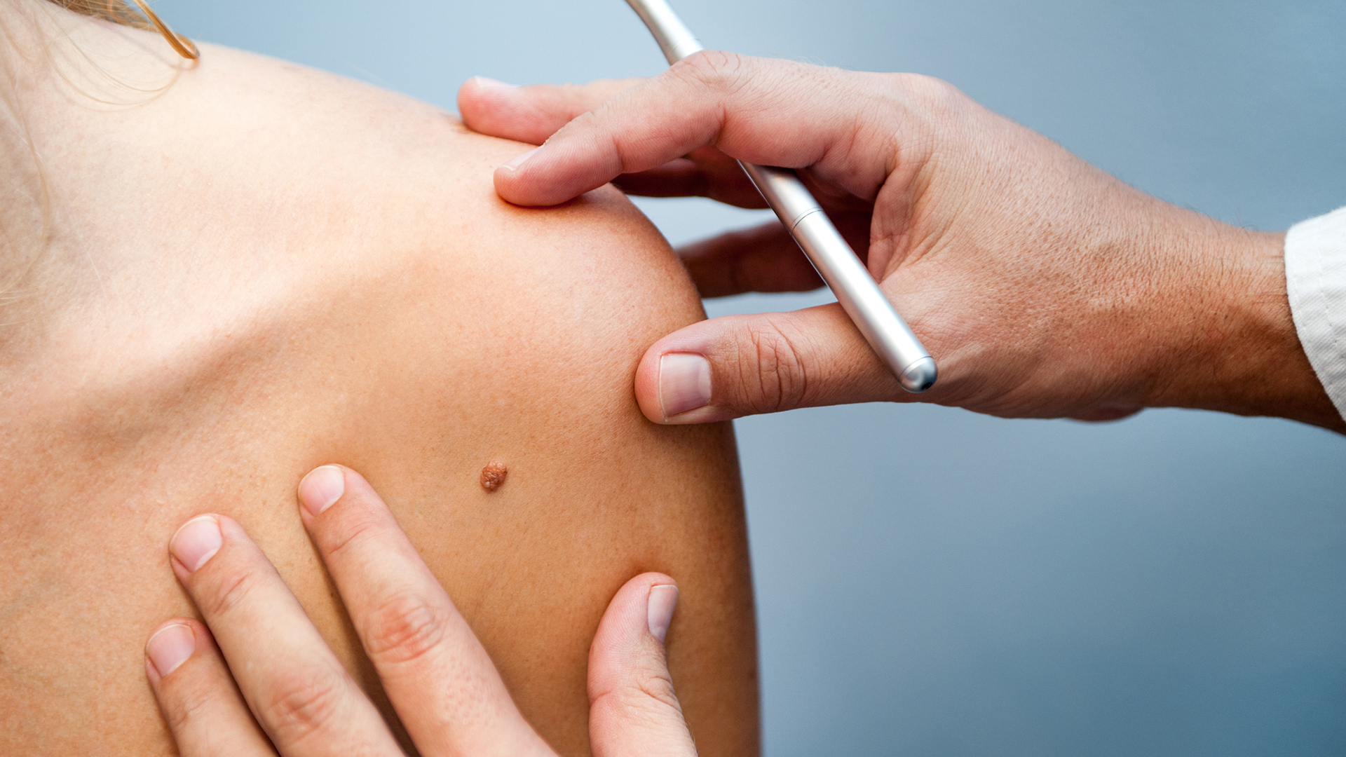 Skin Cancer Testing