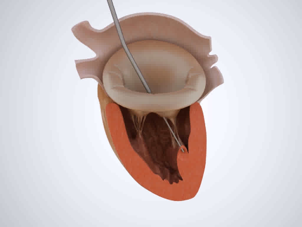 3D Heart Animation