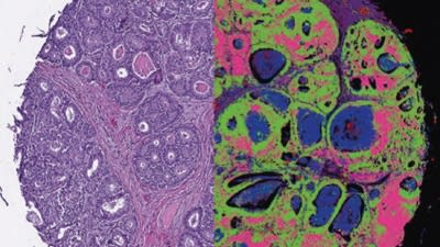 Facility Focus: National Institute of Biomedical Imaging and