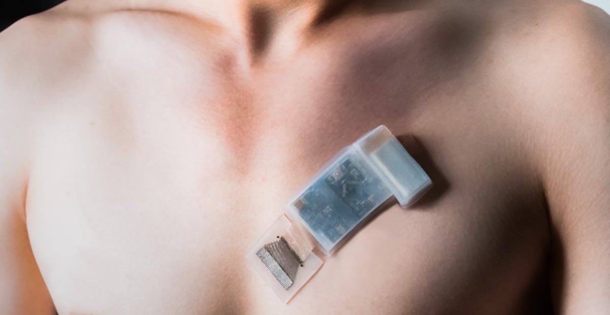 A Fully Integrated Autonomous Wearable Ultrasonic SystemonPatch (USoP