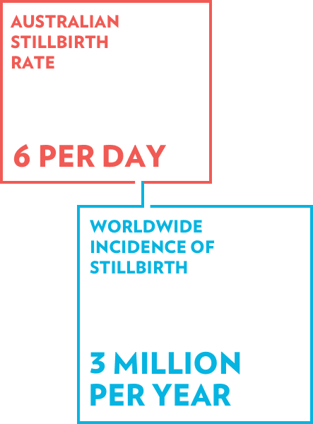 Australia stillbirth rate: 6 per day; worldwide incidence of stillbirth: 3 million per year