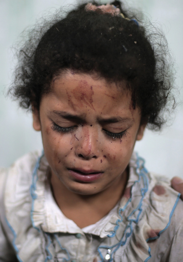 A Palestinian girl cries while receiving treatment for her injuries caused by an Israeli strike at a U.N. school in Jebaliya refugee camp, at the Kamal Adwan hospital in Beit Lahiya, northern Gaza Strip, 30 July, 2014. © Khalil Hamra/AP Photo.