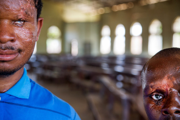 JT Abba, 30, and Naanman P. 30, pose for a
portrait in Kaduna, Nigeria on 4 April, 2013. Both men bear the scars of the St. Rita Catholic church bombing
that took place on 28 October, 2012 in Kaduna, where 4 people died and 192 were injured. © Ed Kashi/VII Photo