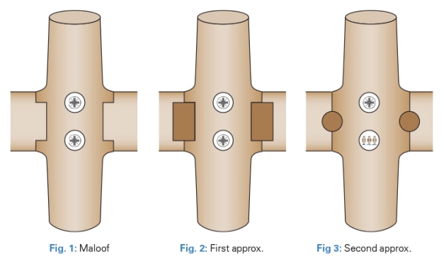 figs1-2-3.jpg