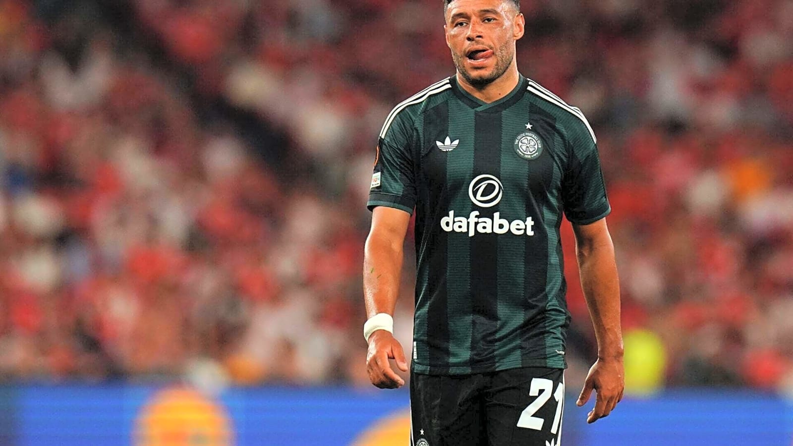 The baffling situation surrounding Alex Oxlade-Chamberlain at Celtic