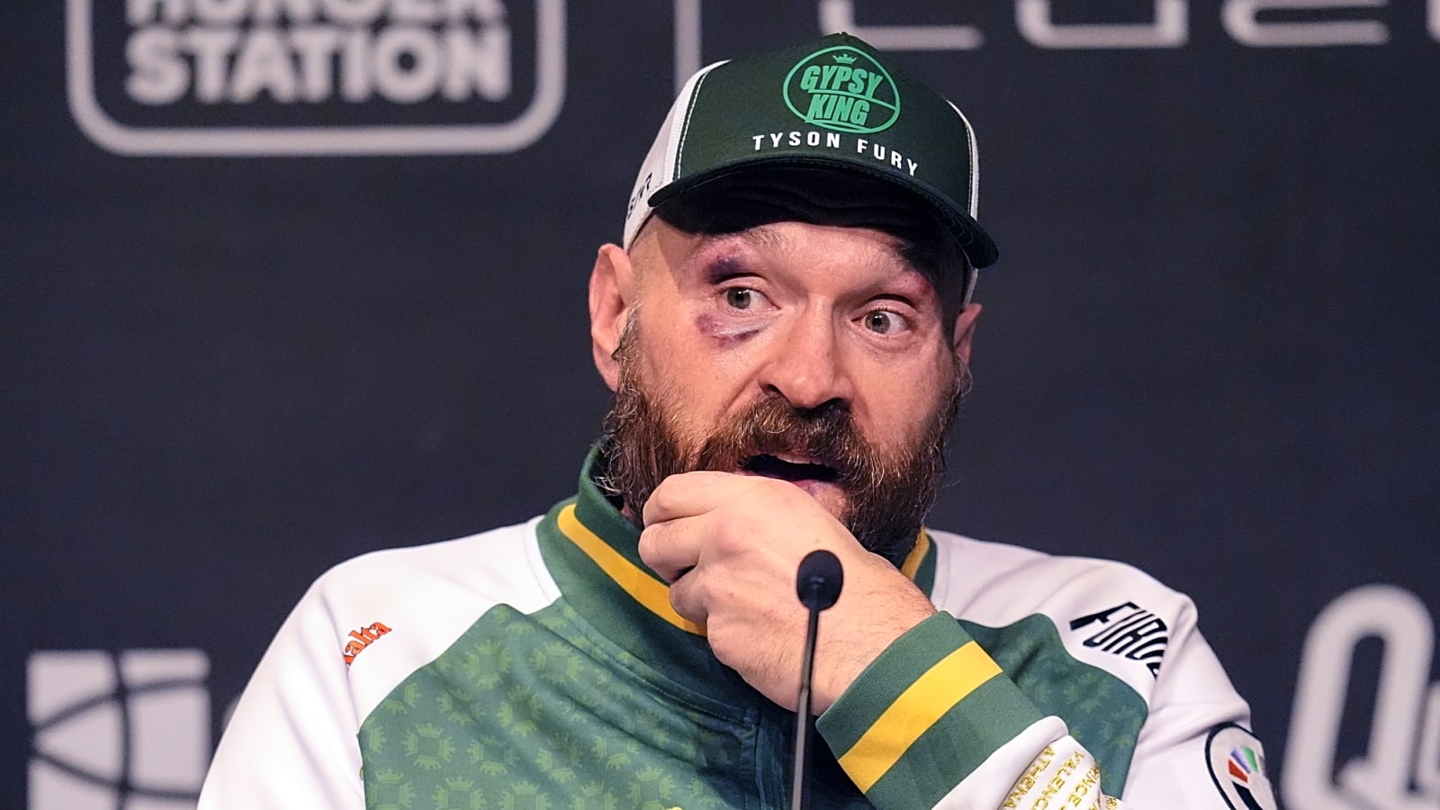 Fury Still Haunted By Usyk Losses – ‘I Beat Him, The World Knows The Truth’
