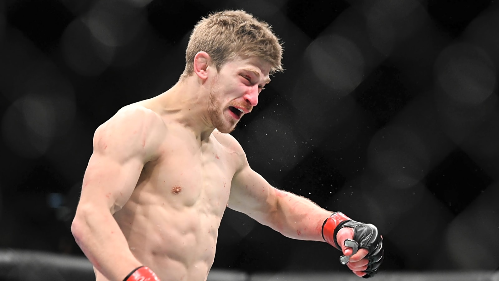 Arnold Allen Attacked on Street for Not Speaking French