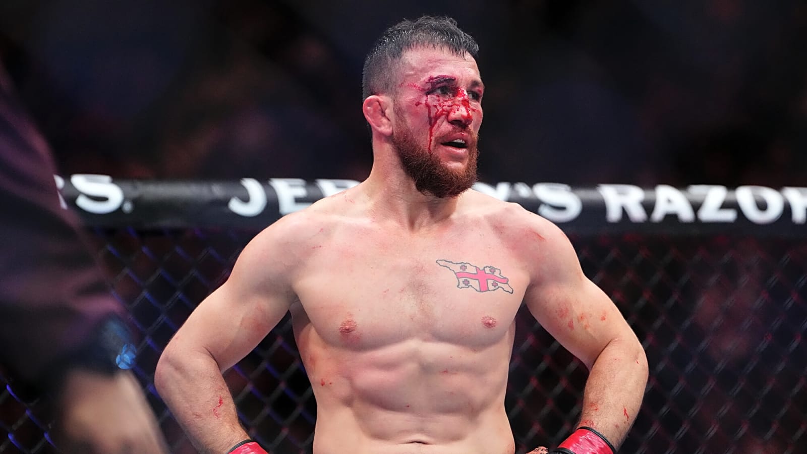 Dvalishvili Blasts Umar Nurmagomedov
