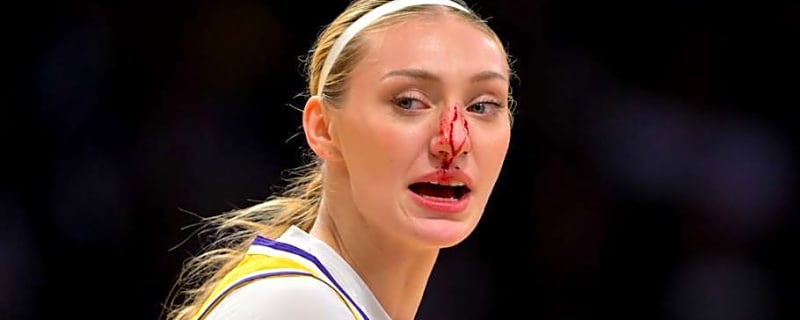 Cameron Brink Breaks Silence on Bloody Injury in Sparks’ Season Finale